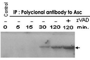 Image no. 2 for anti-NLR Family, Pyrin Domain Containing 1 (NLRP1) antibody (ABIN535031)