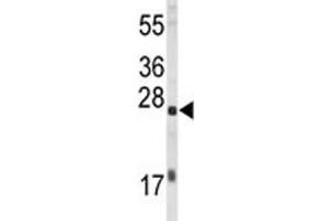 Image no. 4 for anti-Eukaryotic Translation Initiation Factor 4E (EIF4E) antibody (ABIN3030891)