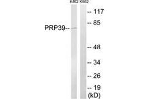 Image no. 1 for anti-Pre-mRNA Processing Factor 39 (PRPF39) (AA 263-312) antibody (ABIN1535198)