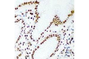 Image no. 1 for anti-Retinoblastoma Binding Protein 7 (RBBP7) antibody (ABIN2966975)