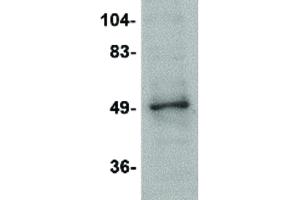 Image no. 1 for anti-Zinc Finger and BTB Domain Containing 2 (ZBTB2) (Internal Region) antibody (ABIN6656860)