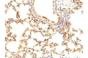 Image no. 1 for anti-Spleen tyrosine Kinase (SYK) (pTyr323) antibody (ABIN6256708)