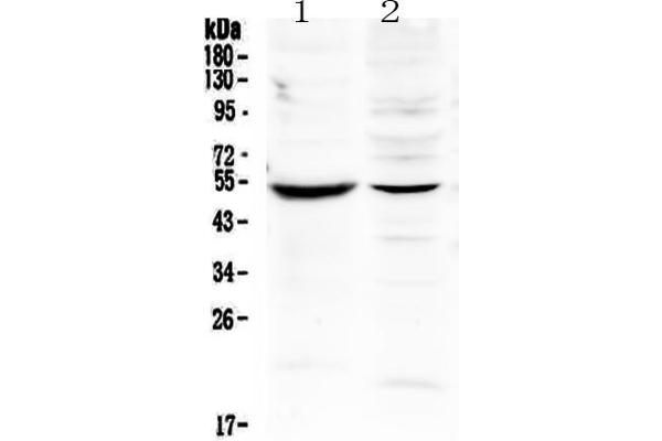 anti-Matrix Metallopeptidase 16 (Membrane-inserted) (MMP16) (AA 120-296) antibody