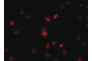 Image no. 3 for anti-Nucleoporin 107kDa (NUP107) (Internal Region) antibody (ABIN6656560)