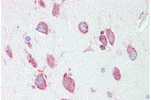 Image no. 1 for anti-Hexosaminidase A (HEXA) (AA 142-170) antibody (ABIN1901794)