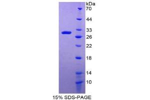Image no. 1 for Damage-Specific DNA Binding Protein 2, 48kDa (DDB2) (AA 166-383) protein (His tag,T7 tag) (ABIN1980714)
