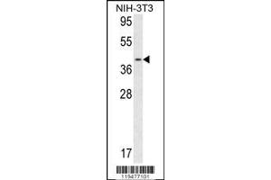Image no. 1 for anti-Calponin 3, Acidic (CNN3) (AA 129-158) antibody (ABIN390504)