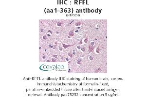 Image no. 1 for anti-Ring Finger and FYVE-Like Domain Containing 1 (RFFL) (AA 1-363) antibody (ABIN1738841)