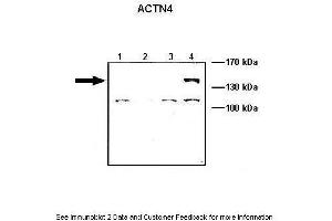 Image no. 3 for anti-Actinin, alpha 4 (ACTN4) (C-Term) antibody (ABIN2775289)