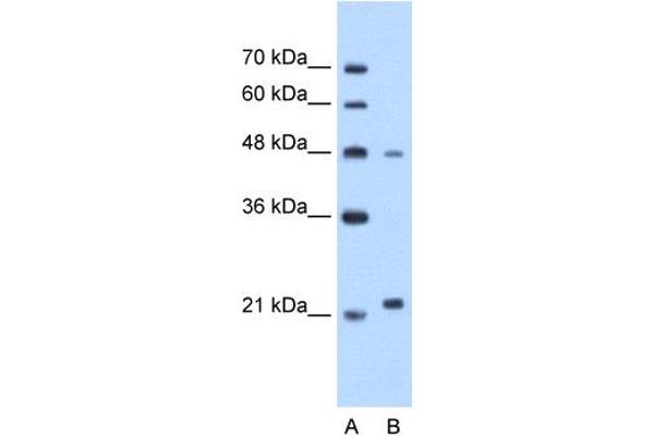 anti-Matrix Metallopeptidase 1 (Interstitial Collagenase) (MMP1) (N-Term) antibody