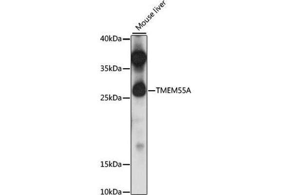 TMEM55A antibody  (AA 130-195)