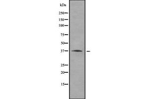 anti-Ras-Related GTP Binding A (RRAGA) (C-Term) antibody