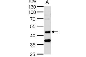Image no. 1 for anti-serine/threonine Kinase 24 (STK24) (Internal Region), (Thr178) antibody (ABIN2856894)