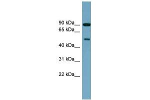 Image no. 1 for anti-Phosphatidylinositol 4-Kinase Type 2 beta (PI4K2B) (Middle Region) antibody (ABIN2787117)