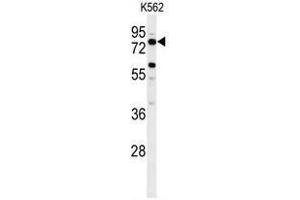 anti-Acyl-CoA Synthetase Bubblegum Family Member 2 (ACSBG2) (AA 244-273), (Middle Region) antibody