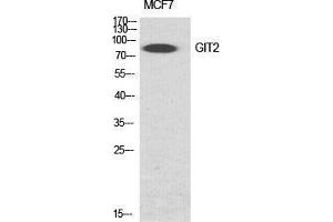 Image no. 2 for anti-G Protein-Coupled Receptor Kinase Interactor 2 (GIT2) (Internal Region) antibody (ABIN3184796)