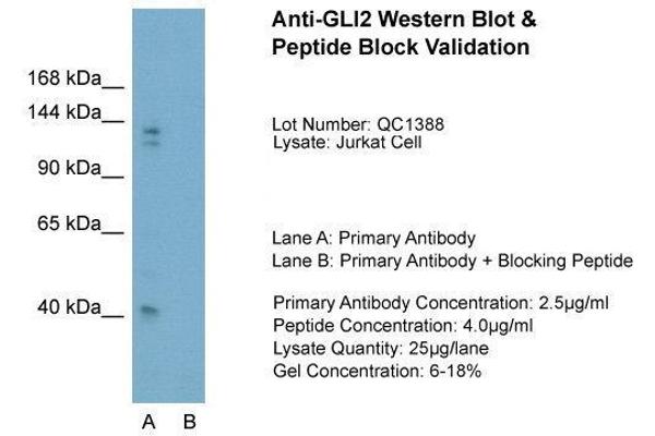 anti-GLI Family Zinc Finger 2 (GLI2) (Middle Region) antibody