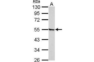 Image no. 2 for anti-Retinoic Acid Receptor, gamma (RARG) (Center) antibody (ABIN2855516)