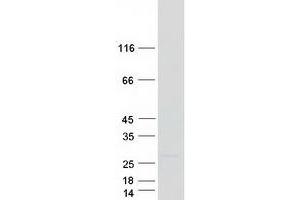 Image no. 1 for NADH Dehydrogenase (Ubiquinone) 1 alpha Subcomplex, 8, 19kDa (NDUFA8) protein (Myc-DYKDDDDK Tag) (ABIN2727009)