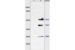 Image no. 2 for anti-Transmembrane Protein 8B (TMEM8B) (AA 21-120) antibody (ABIN737136)
