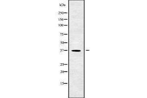 Image no. 1 for anti-Calponin 3, Acidic (CNN3) antibody (ABIN6260911)