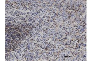 Image no. 4 for anti-Mitogen-Activated Protein Kinase Kinase Kinase 11 (MAP3K11) (AA 741-847) antibody (ABIN517943)