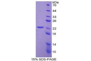 Image no. 1 for Baculoviral IAP Repeat Containing 2 (BIRC2) protein (ABIN1169928)