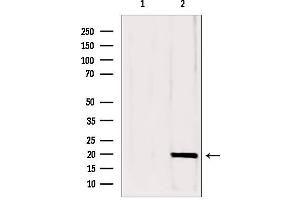 anti-Complexin 1 (CPLX1) (N-Term) antibody