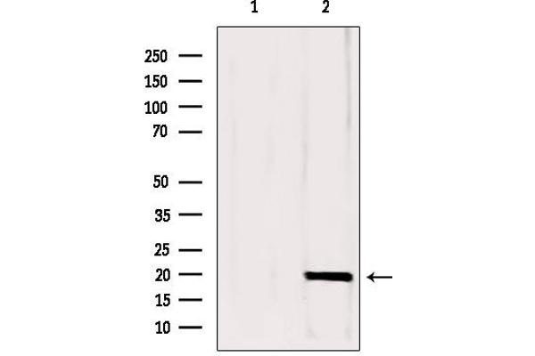 anti-Complexin 1 (CPLX1) (N-Term) antibody