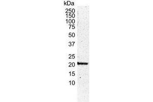 Image no. 1 for anti-HRas proto-oncogene, GTPase (HRAS) antibody (ABIN2473919)