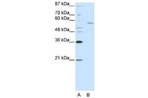 Image no. 2 for anti-REST Corepressor 1 (RCOR1) (C-Term) antibody (ABIN2780966)