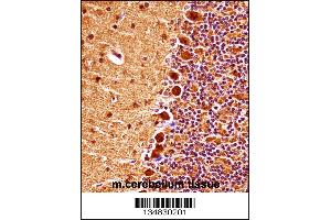 Image no. 1 for anti-Mitogen-Activated Protein Kinase 9 (MAPK9) (Center) antibody (ABIN2447985)