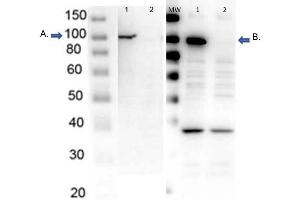Image no. 5 for anti-Poly (ADP-Ribose) Polymerase 1 (PARP1) (C-Term) antibody (ABIN5596914)