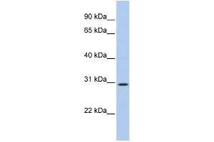 Image no. 1 for anti-TP53 Target 5 (TP53TG5) (N-Term) antibody (ABIN2785522)