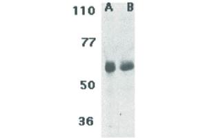 Image no. 1 for anti-TRAF3 Interacting Protein 2 (TRAF3IP2) (N-Term) antibody (ABIN6655288)
