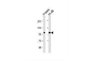 Image no. 3 for anti-SUMO1/sentrin Specific Protease 6 (SENP6) (AA 1081-1112), (C-Term) antibody (ABIN388052)