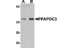 Western blot analysis of PPAPDC3 in mouse heart tissue lysate with PPAPDC3 antibody at (A) 1 and (B) 2 µg/mL.
