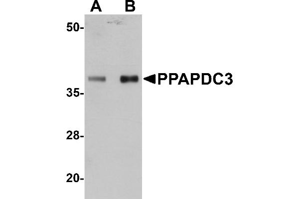 PPAPDC3 Antikörper  (Middle Region)