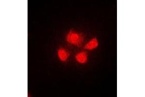 Image no. 1 for anti-Alveolar Soft Part Sarcoma Chromosome Region, Candidate 1 (ASPSCR1) antibody (ABIN2967121)