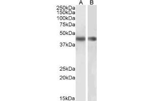 Image no. 7 for anti-Actin, alpha 2, Smooth Muscle, Aorta (ACTA2) (N-Term) antibody (ABIN185271)