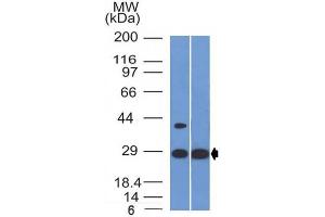 Image no. 1 for anti-Erythropoietin (EPO) (AA 28-162) antibody (ABIN6939313)