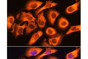 Immunofluorescence analysis of U20S cells using RIG-I / DDX58 Polyclonal Antibody at dilution of 1:100.