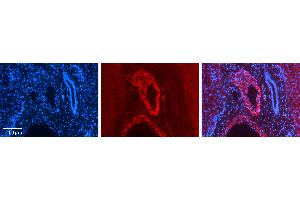 Image no. 3 for anti-ZFP36 Ring Finger Protein-Like 1 (ZFP36L1) (Middle Region) antibody (ABIN2780624)