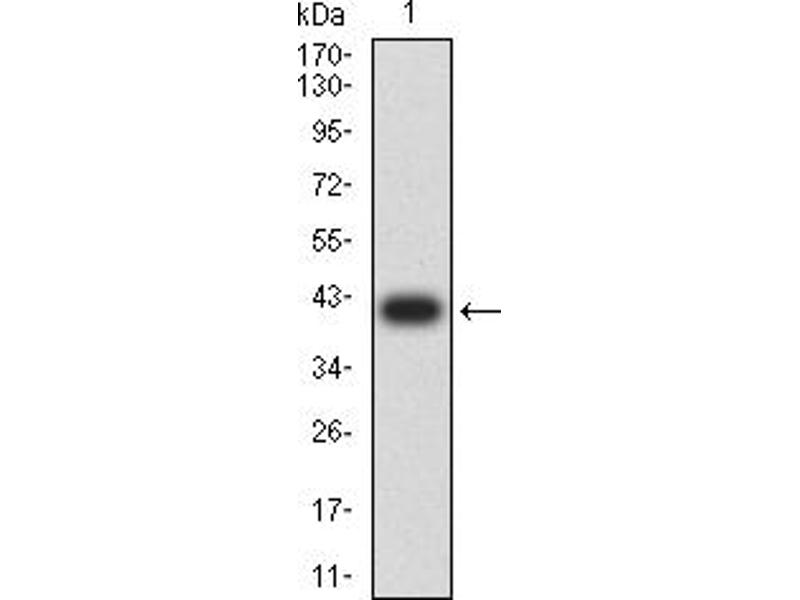 Anti C1qc Antibody 115 245 Product No Abin