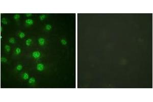 Immunofluorescence analysis of HuvEc cells treated with serum 20% 30', using p57 Kip2 (Phospho-Thr310) Antibody.