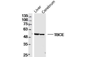 Image no. 1 for anti-Tubulin Folding Cofactor E (TBCE) (AA 1-100) antibody (ABIN5675475)
