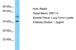 ZNF114 antibody  (C-Term)