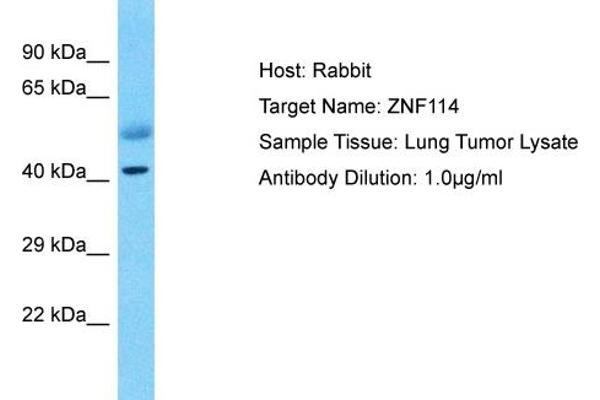 ZNF114 antibody  (C-Term)