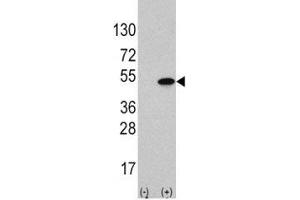 Image no. 2 for anti-Activating Transcription Factor 4 (Tax-Responsive Enhancer Element B67) (ATF4) (AA 220-252) antibody (ABIN3029848)