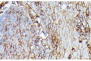 Immunohistochemistry of paraffin-embedded Human esophageal using HLA-B Polyclonal Antibody at dilution of 1:100 (40x lens).